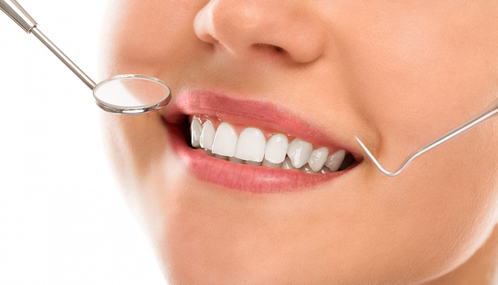Duración y mantenimiento de las carillas dentales