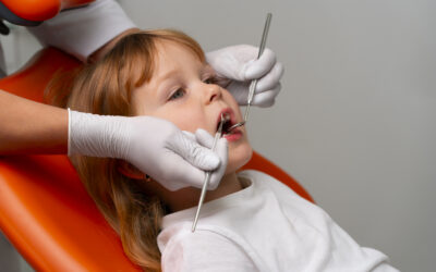 ¿Qué son los selladores dentales?